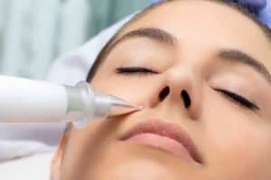 Best Actinic Keratoses Removal 3 Actinic keratoses Salford Quays solutions - book in today!